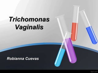 Trichomonas
Vaginalis
Robianna Cuevas
 