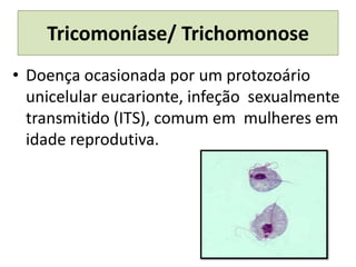 Tricomoníase/ Trichomonose
• Doença ocasionada por um protozoário
unicelular eucarionte, infeção sexualmente
transmitido (ITS), comum em mulheres em
idade reprodutiva.
 