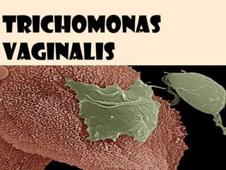Trichomonas
vaginalis
 