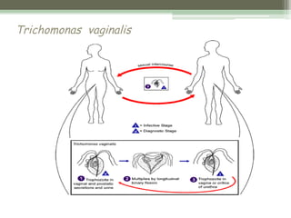 Trichomonas vaginalis
 