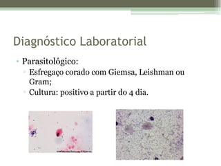 Diagnóstico Laboratorial
• Parasitológico:
▫ Esfregaço corado com Giemsa, Leishman ou
Gram;
▫ Cultura: positivo a partir do 4 dia.
 