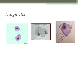 T.vaginalis
 