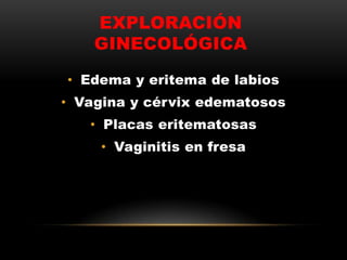EXPLORACIÓN
GINECOLÓGICA
• Edema y eritema de labios
• Vagina y cérvix edematosos
• Placas eritematosas
• Vaginitis en fresa
 