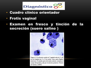 • Cuadro clínico orientador
• Frotis vaginal
• Examen en fresco y tinción de la
secreción (suero salino )
 