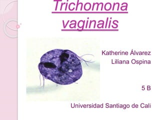 Trichomona
vaginalis
Katherine Álvarez
Liliana Ospina
5 B
Universidad Santiago de Cali
 