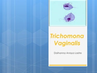 Trichomona
Vaginalis
Daihanna Anaya Lastre

 