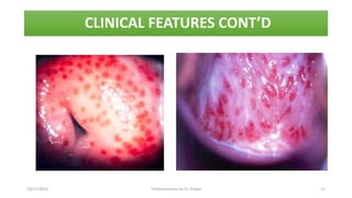 10/17/2023 Trichomoniasis by Dr. Elioba 11
CLINICAL FEATURES CONT’D
 