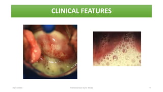 CLINICAL FEATURES
10/17/2023 Trichomoniasis by Dr. Elioba 9
 