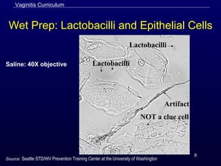 8
Wet Prep: Lactobacilli and Epithelial Cells
Saline: 40X objective Lactobacilli
Lactobacilli
Artifact
NOT a clue cell
Vaginitis Curriculum
Source: Seattle STD/HIV Prevention Training Center at the University of Washington
 