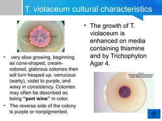 T. violaceum cultural characteristics

•

very slow growing, beginning
as cone-shaped, creamcolored, glabrous colonies then
will turn heaped up, verrucous
(warty), violet to purple, and
waxy in consistency. Colonies
may often be described as
being “port wine” in color.
• The reverse side of the colony
is purple or nonpigmented.

• The growth of T.
violaceum is
enhanced on media
containing thiamine
and by Trichophyton
Agar 4.

 