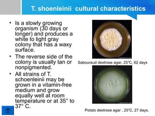 T. shoenleinii cultural characteristics
• Is a slowly growing
organism (30 days or
longer) and produces a
white to light gray
colony that has a waxy
surface.
• The reverse side of the
colony is usually tan or
nonpigmented.
• All strains of T.
schoenleinii may be
grown in a vitamin-free
medium and grow
equally well at room
temperature or at 35° to
37° C.

Sabouraud dextrose agar, 25℃, 62 days

Potato dextrose agar , 25℃, 27 days.

 