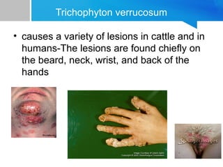 Trichophyton verrucosum
• causes a variety of lesions in cattle and in
humans-The lesions are found chiefly on
the beard, neck, wrist, and back of the
hands

 