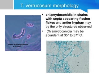 T. verrucosum morphology
• chlamydoconidia in chains
with septa appearing fission
flakes and antler hyphae may
be the only structures observed
• Chlamydoconidia may be
abundant at 35° to 37° C.

 