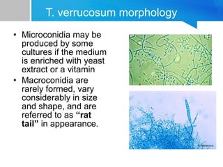 T. verrucosum morphology
• Microconidia may be
produced by some
cultures if the medium
is enriched with yeast
extract or a vitamin
• Macroconidia are
rarely formed, vary
considerably in size
and shape, and are
referred to as “rat
tail” in appearance.

 