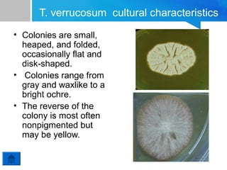 T. verrucosum cultural characteristics
• Colonies are small,
heaped, and folded,
occasionally flat and
disk-shaped.
• Colonies range from
gray and waxlike to a
bright ochre.
• The reverse of the
colony is most often
nonpigmented but
may be yellow.

 