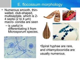 E. flocossum morphology
• Numerous smooth, thinwalled, club-shaped,
multiseptate, which is 24 septa (2 to 4 μm)
macro- conidia are seen
– is useful in
differentiating it from
Microsporum species.

•Spiral hyphae are rare,
and chlamydoconidia are
usually numerous.

 
