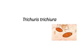 Trichuris trichiura
 