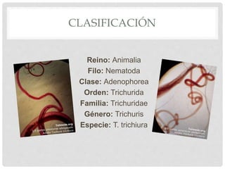 CLASIFICACIÓN
Reino: Animalia
Filo: Nematoda
Clase: Adenophorea
Orden: Trichurida
Familia: Trichuridae
Género: Trichuris
Especie: T. trichiura
 