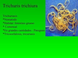 Trichuris trichiura
Trichuriasis
*Nematodo
*Habitat: Intestino grueso
* Comensal
*En grandes cantidades : Patogeno
*Tricocefalosis, tricuriasis
 