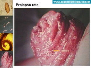 Prolapso retal
www.euquerobiologia.com.br
 
