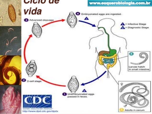 Trichuris trichiura (Cacing Cambuk)