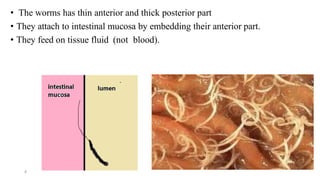• The worms has thin anterior and thick posterior part
• They attach to intestinal mucosa by embedding their anterior part.
• They feed on tissue fluid (not blood).
4
 