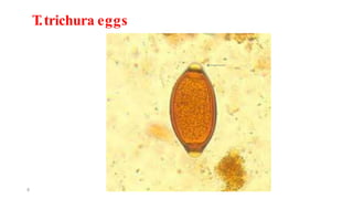 T.trichura eggs
8
 