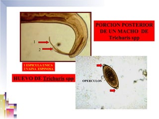 PORCION POSTERIOR
                                DE UN MACHO DE
                                   Trichuris spp
        1

            2


   1 ESPICULA UNICA
   2 VAINA ESPINOSA


HUEVO DE Trichuris spp   OPERCULOS
 
