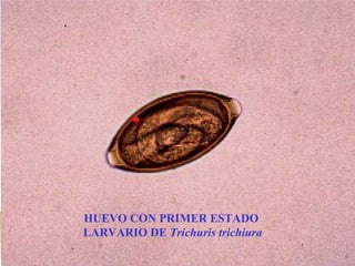 HUEVO CON PRIMER ESTADO
LARVARIO DE Trichuris trichiura
 