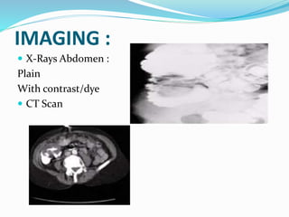 IMAGING :
 X-Rays Abdomen :
Plain
With contrast/dye
 CT Scan
 