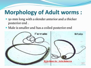 Morphology of Adult worms :
 50 mm long with a slender anterior and a thicker
posterior end .
 Male is smaller and has a coiled posterior end
 
