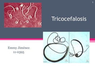 Tricocefalosis
Emmy Jiménez
11-0395
1
 
