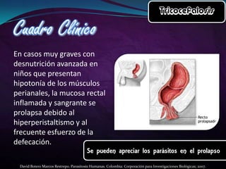 En casos muy graves con
desnutrición avanzada en
niños que presentan
hipotonía de los músculos
perianales, la mucosa rectal
inflamada y sangrante se
prolapsa debido al
hiperperistaltismo y al
frecuente esfuerzo de la
defecación.
David Botero Marcos Restrepo. Parasitosis Humanas. Colombia: Corporación para Investigaciones Biológicas; 2007.

 