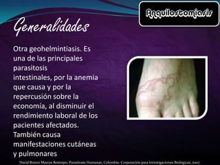 Otra geohelmintiasis. Es
una de las principales
parasitosis
intestinales, por la anemia
que causa y por la
repercusión sobre la
economía, al disminuir el
rendimiento laboral de los
pacientes afectados.
También causa
manifestaciones cutáneas
y pulmonares
David Botero Marcos Restrepo. Parasitosis Humanas. Colombia: Corporación para Investigaciones Biológicas; 2007.

 