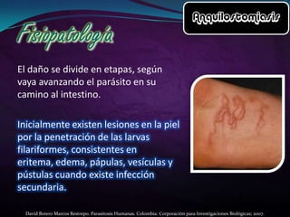 El daño se divide en etapas, según
vaya avanzando el parásito en su
camino al intestino.

Inicialmente existen lesiones en la piel
por la penetración de las larvas
filariformes, consistentes en
eritema, edema, pápulas, vesículas y
pústulas cuando existe infección
secundaria.
David Botero Marcos Restrepo. Parasitosis Humanas. Colombia: Corporación para Investigaciones Biológicas; 2007.

 