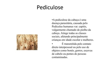 Pediculose
•A pediculose da cabeça é uma
doença parasitária, causada pelo
Pediculus humanus var. capitis,
vulgarmente chamado de piolho da
cabeça. Atinge todas as classes
sociais, afetando principalmente
crianças em idade escolar e mulheres.
•
É transmitida pelo contato
direto interpessoal ou pelo uso de
objetos como bonés, gorros, escovas
de cabelo ou pentes de pessoas
contaminadas.

 