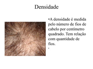 Densidade

     •A densidade é medida
     pelo número de fios de
     cabelo por centímetro
     quadrado. Tem relação
     com quantidade de
     fios.
     •
 