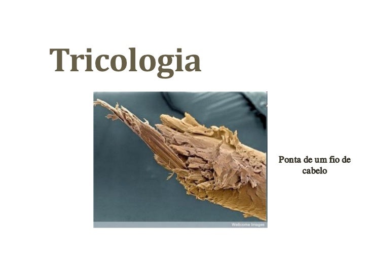 TRICOLOGIA CAPILAR EBOOK DOWNLOAD TRICOLOGIA CAPILAR EBOOK DOWNLOAD