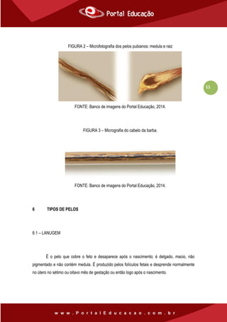 11
FIGURA 2 – Microfotografia dos pelos pubianos: medula e raiz
FONTE: Banco de imagens do Portal Educação, 2014.
FIGURA 3 – Micrografia do cabelo da barba.
FONTE: Banco de imagens do Portal Educação, 2014.
6 TIPOS DE PELOS
6.1 – LANUGEM
É o pelo que cobre o feto e desaparece após o nascimento; é delgado, macio, não
pigmentado e não contém medula. É produzido pelos folículos fetais e desprende normalmente
no útero no sétimo ou oitavo mês de gestação ou então logo após o nascimento.
 
