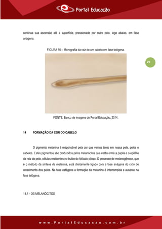 29
continua sua ascensão até a superfície, pressionado por outro pelo, logo abaixo, em fase
anágena.
FIGURA 16 – Micrografia da raiz de um cabelo em fase telógena.
FONTE: Banco de imagens do Portal Educação, 2014.
14 FORMAÇÃO DA COR DO CABELO
O pigmento melanina é responsável pela cor que vemos tanto em nossa pele, pelos e
cabelos. Estes pigmentos são produzidos pelos melanócitos que estão entre a papila e o epitélio
da raiz do pelo, células residentes no bulbo do folículo piloso. O processo de melanogênese, que
é o método da síntese da melanina, está diretamente ligado com a fase anágena do ciclo de
crescimento dos pelos. Na fase catágena a formação da melanina é interrompida e ausente na
fase telógena.
14.1 - OS MELANÓCITOS
 