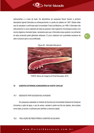 70
sobrancelhas e a área da testa. Os laboratórios de pesquisas Nioxin fizeram a primeira
descoberta ligando Demodex ao enfraquecimento e a perda de cabelos em 1997. Desde então
isso foi estudado e confirmado pela Universidade Tulane de Medicina, em 1999. A Demodex não
está presente no couro cabeludo de todas as pessoas. Este organismo microscópico produz uma
enzima digestiva chamada lípase, necessária para que o Demodex possa quebrar e se alimentar
do sebo produzido pelas glândulas sebáceas. O couro cabeludo com quantidade excessiva de
sebo é propício para a sua proliferação.
Figura 48 – Demodex folliculorum.
FONTE: Banco de imagens do Portal Educação, 2014.
19 AGENTES EXTERNOS AGRESSORES DA HASTE CAPILAR
19.1 DESGASTE POR SUCESSIVAS LAVAGENS
Em pesquisas realizadas no Instituto de Química da Universidade Estadual de Campinas
(Unicamp) a ação da água, o uso do xampu, secador e pente nos fios de cabelos, atos simples
como estes, já seriam o suficiente para danificar a estrutura capilar.
19.2 PELA AÇÃO DE REDUTORES E AGENTES ALCALINOS
 