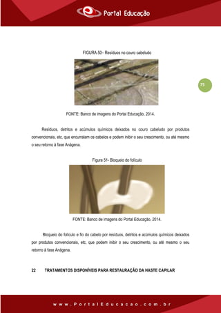 75
FIGURA 50– Resíduos no couro cabeludo
FONTE: Banco de imagens do Portal Educação, 2014.
Resíduos, detritos e acúmulos químicos deixados no couro cabeludo por produtos
convencionais, etc, que encurralam os cabelos e podem inibir o seu crescimento, ou até mesmo
o seu retorno à fase Anágena.
Figura 51- Bloqueio do folículo
FONTE: Banco de imagens do Portal Educação, 2014.
Bloqueio do folículo e fio do cabelo por resíduos, detritos e acúmulos químicos deixados
por produtos convencionais, etc, que podem inibir o seu crescimento, ou até mesmo o seu
retorno à fase Anágena.
22 TRATAMENTOS DISPONÍVEIS PARA RESTAURAÇÃO DA HASTE CAPILAR
 