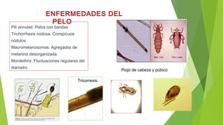 Pili annulati: Pelos con bandas
Trichorrhexis nodosa: Conspicuos
nódulos
Macromelanosomas: Agregados de
melanina desorganizada.
Monilethrix: Fluctuaciones regulares del
diámetro
ENFERMEDADES DEL
PELO
Tricorrexis.
Piojo de cabeza y púbico
 