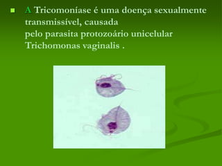  A Tricomoníase é uma doença sexualmente
transmissível, causada
pelo parasita protozoário unicelular
Trichomonas vaginalis .
 