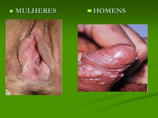  MULHERES HOMENS
 