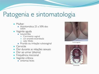 Patogenia e sintomatologia
● Mulher
● Assintomática: 25 a 50% dos
casos
● Vaginite aguda
● Leucorréia
● Corrimento vaginal
● cor amarelo-esverdeada
● odor fétido
● Prurido ou irritação vulvovaginal
● Cervicite
● Dor durante as relações sexuais
● Dor ao urinar (disúria)
● Frequência miccional
● Vaginite crônica
● sintomas leves
 
