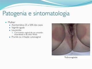 Patogenia e sintomatologia
● Mulher
● Assintomática: 25 a 50% dos casos
● Vaginite aguda
● Leucorréia
● Corrimento vaginal de cor amarelo-
esverdeada e de odor fétido
● Prurido ou irritação vulvovaginal
 