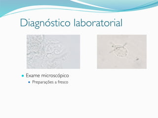 Diagnóstico laboratorial
● Exame microscópico
● Preparações a fresco
 