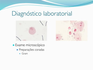 Diagnóstico laboratorial
● Exame microscópico
● Preparações coradas
● Gram
 