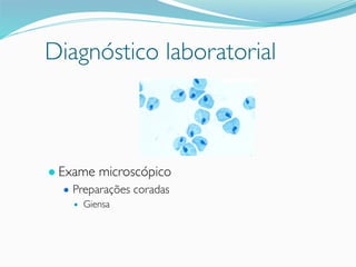 Diagnóstico laboratorial
● Exame microscópico
● Preparações coradas
● Giensa
 